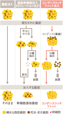 コンデンスリッチ豊胸と脂肪幹細胞注入の違い