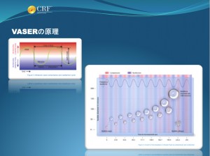 ベイザー脂肪吸引 研究 資料 ブログ