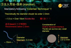 脂肪注入豊胸の基礎知識