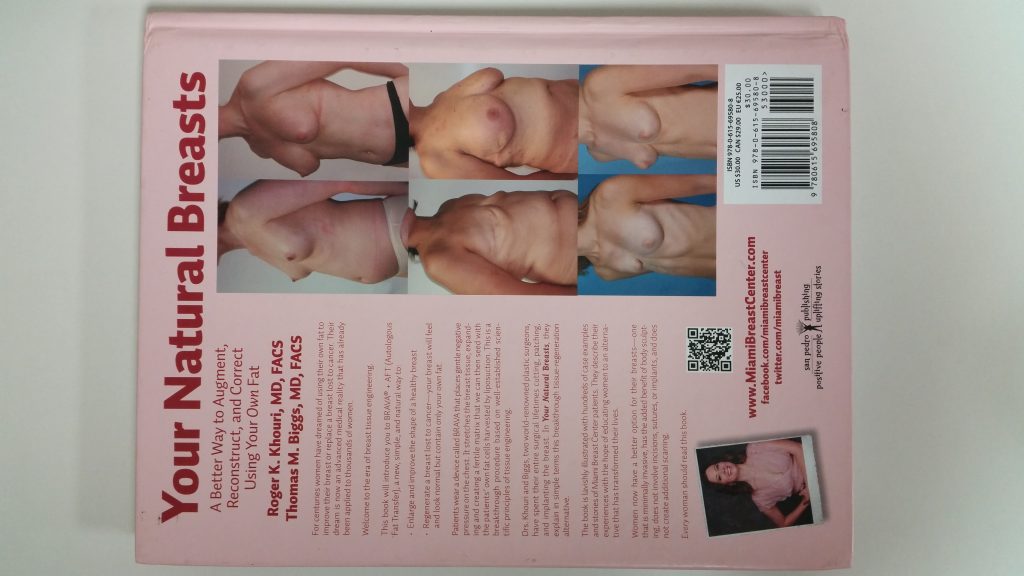 乳がん術後の乳房再建にも使用される:脂肪による豊胸