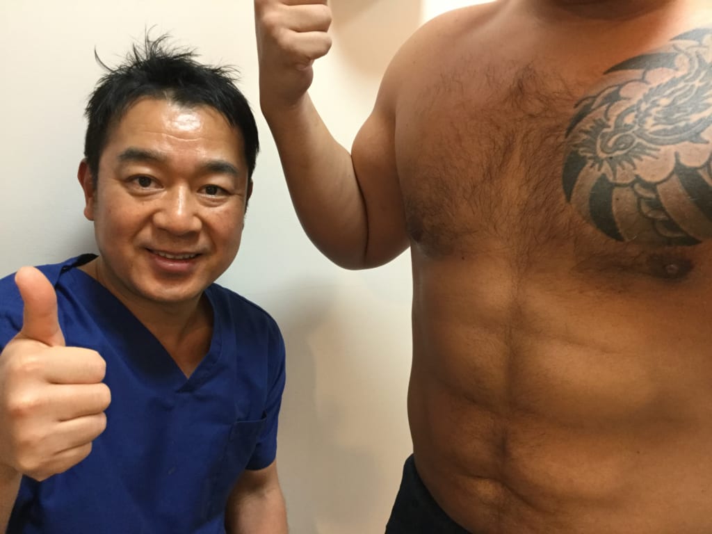 VASER4D 男性シックスパック 腰もスッキリ 術後3か月