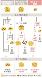 豊胸の種類比較
