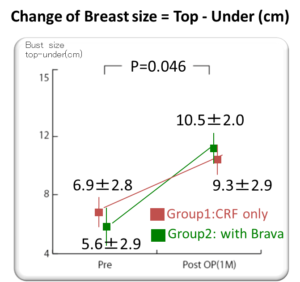 brava併用crf豊胸