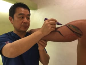 ベイザー4d 男性上腕