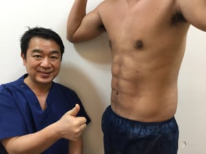 男性の脂肪吸引 シックスパック