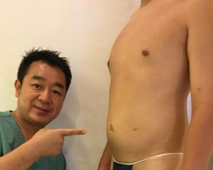 脂肪吸引 腹部