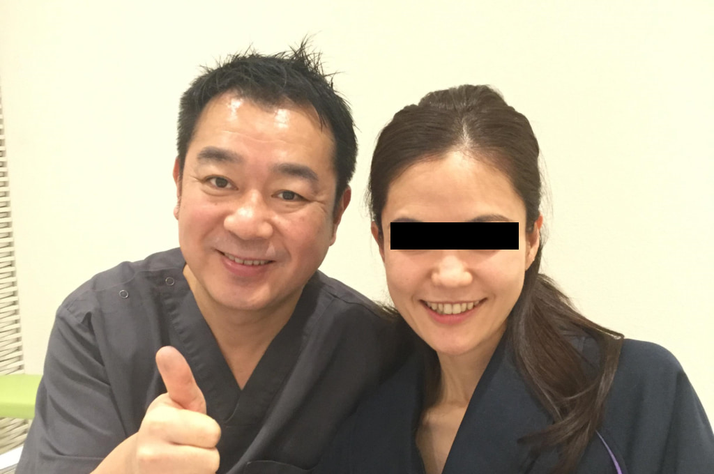 脂肪注入+糸による若返り:術後1か月、40代には思えない輝きの笑顔