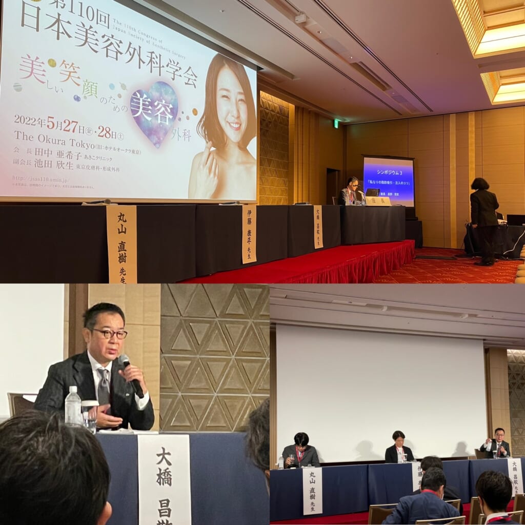 日本美容外科学会総会：脂肪吸引、脂肪注入シンポジウムでの発表無事終了しました。